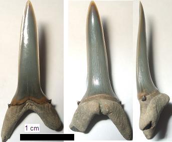 Anterior tooth from 3 points of view