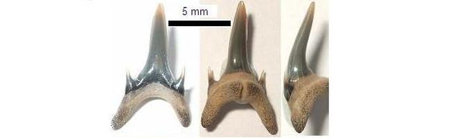 O.winkleri anterior tooth from 3 points of view